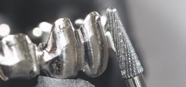 cs-brasseler-teeth-metal-work_600x280